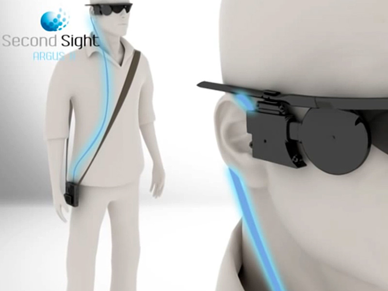 Vision artificial