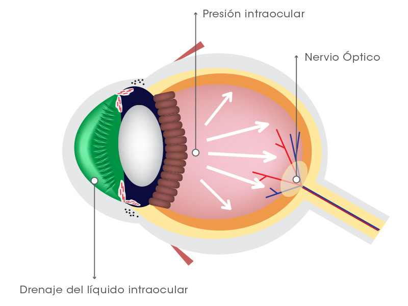 Esquema presión intraocular