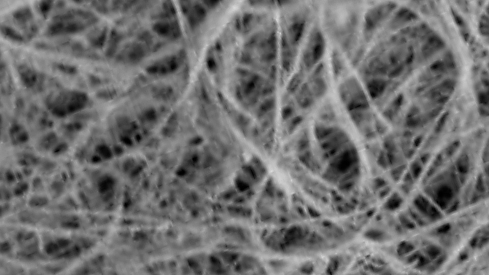 Nanocelulosa
