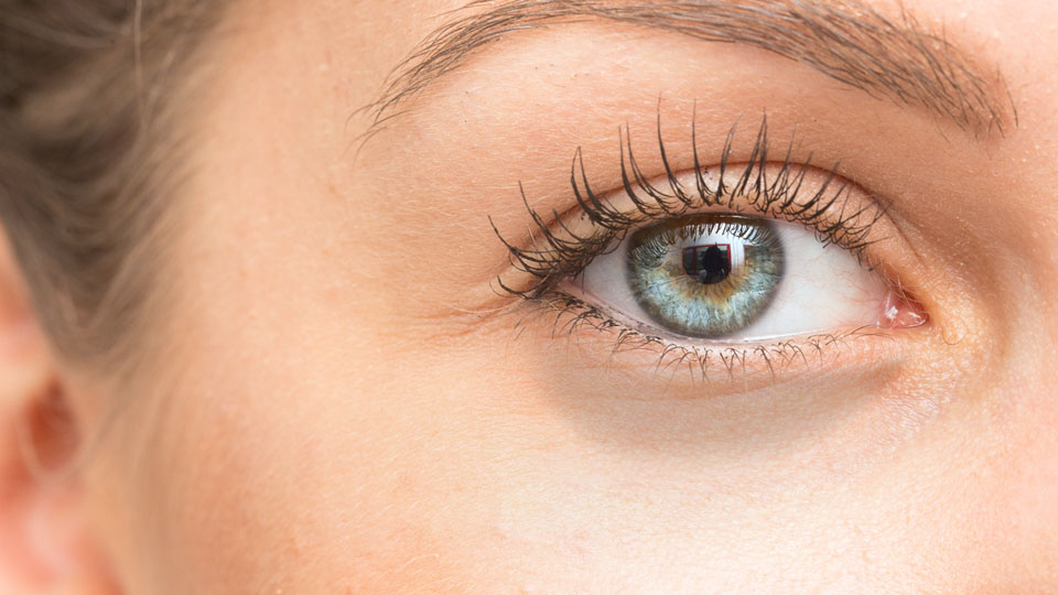 Tratamiento para los diferentes tipos de ojeras