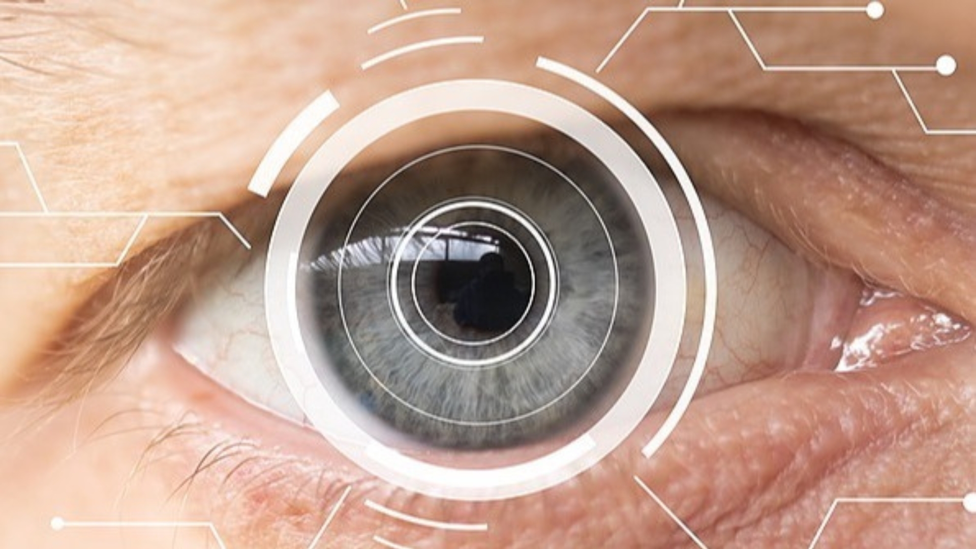 Curso Biometría y cálculo de la lente intraocular